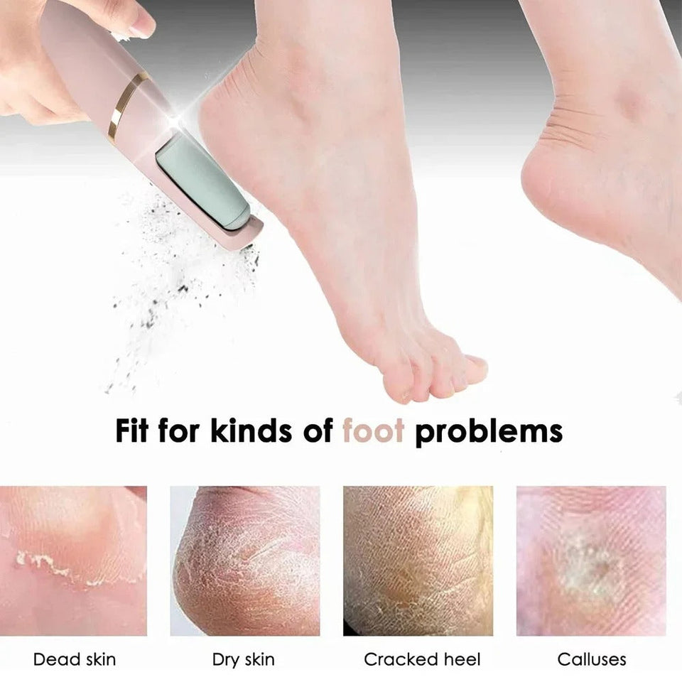 Electric Foot Callus Remover & Grinder – Rechargeable Foot File with Vacuum for Cracked Heels & Dead Skin