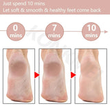 Electric Foot Callus Remover & Grinder – Rechargeable Foot File with Vacuum for Cracked Heels & Dead Skin