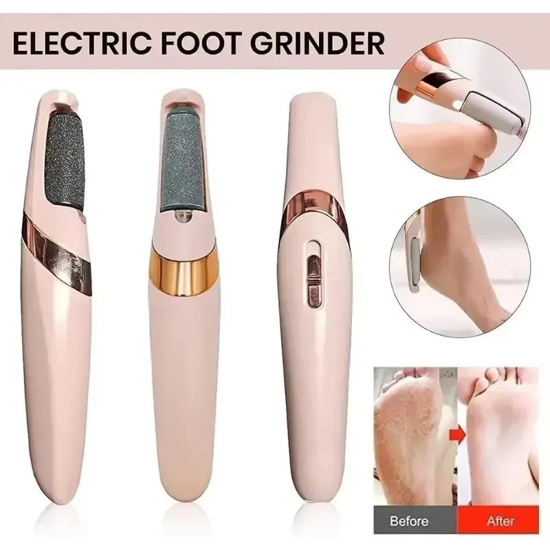 Electric Foot Callus Remover & Grinder – Rechargeable Foot File with Vacuum for Cracked Heels & Dead Skin